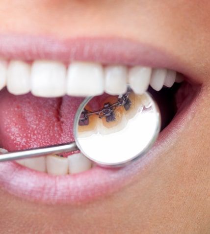 orthodontiste Maisons-Alfort 94