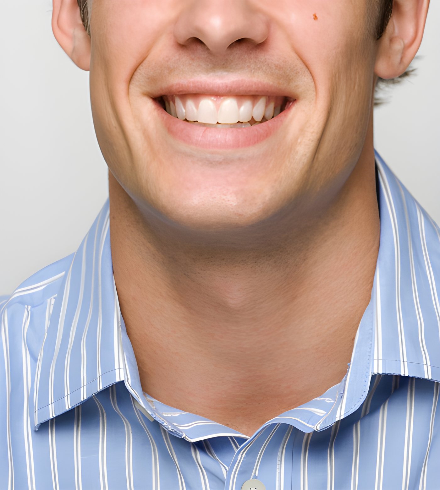 Orthodontie adultes